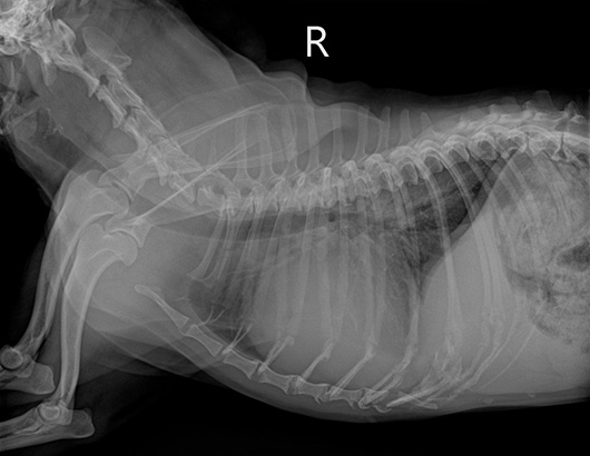 心拡大のレントゲン