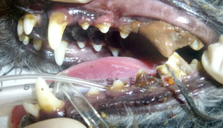 重度に付着した歯石をスケーリングすると・・・