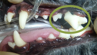 歯槽骨が破壊されて奥歯の歯根が露出してしまっています