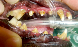 麻酔下スケーリング前