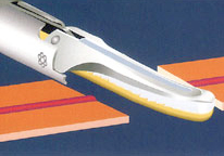 シザーズの先端で挟み込んで凝固、切開する