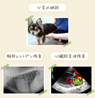 心音の検診・胸部レントゲン検査・心臓超音波検査